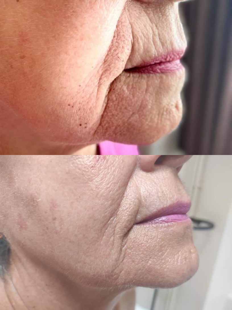 Masáže v Salon Rose